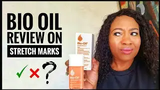 MY HONEST REVIEW BIO OIL FOR STRETCH MARKS .DOES IT WORK?.