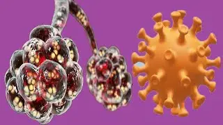 Pneumonia And COVID-19: Relationship