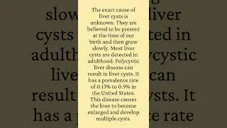 Causes Of liver cysts #shorts