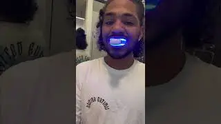 Teeth Whitening Review &ndash; Honest Thoughts & Results