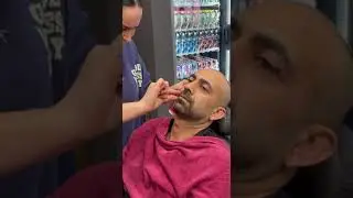 #depilation of the beard with thread#депіляция бороди Ниткою