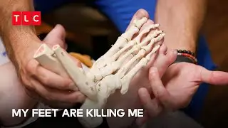 The Problem with Extra Toes | My Feet are Killing Me