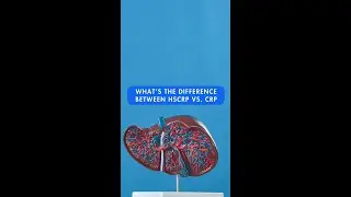 What&rsquo;s the difference between HSCRP vs. CRP