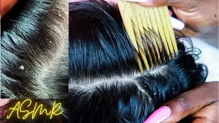 [ASMR] ALLZOOMED Scalp Scratching with an African Wooden Comb