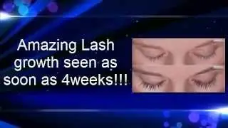 How To Get Longer Lashes With Careprost Latisse Generic