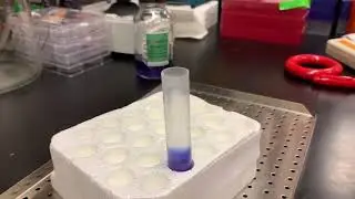 Sucrose Gradient preparation