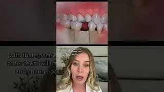 Side effect of having a missing tooth. #dentist #dentistry #missingtooth #teeth