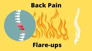 How To Manage Chronic Low Back Pain Flare-Ups chronic pain