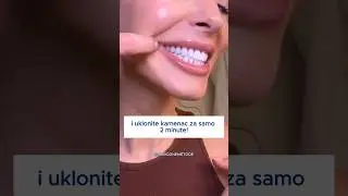 Izbelite Svoje Zube i Uklonite Kamenac za Samo 2 Minuta Dnevno