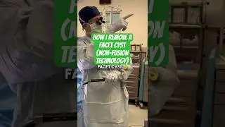 Лечение кисты фасеточного сустава позвоночника
