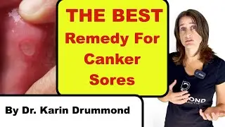 The Best Remedy For Canker Sores