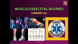Musculoskeletal injuries||Medical First Responders||Lesson -11