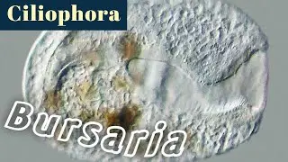 Bursaria, a large ciliate (Ciliophora)