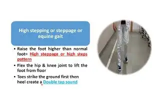 High Stepping Gait