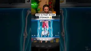 Do NOT X-RAY this Woman.. 😳 | Quarantine Zone