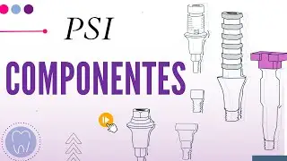 ROOM 1 - PROSTHETIC COMPONENTS ON IMPLANTS