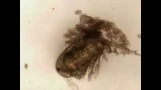 Peritrich on a cyclopoid copepod 8 -7-2014