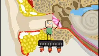 Der Weg des Schalls - ANIMATION
