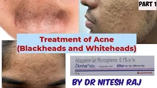 Acne treatment in hindi #drniteshraj deriva adapene acnestar pimple ka ilaz part 1