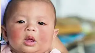 Case Study | Dr. Armaghan Ahmed | Pediatric Robotic Surgeon | Doctors Hospital Lahore