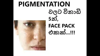 Treatment for pigmentation-sinhala-lifestyle corner