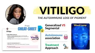 Vitiligo Explained: Autoimmune Causes, Wood Lamp Diagnosis & Modern Treatments