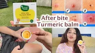 Mother sparsh after bite turmeric balm to treat mosquito and insect bite #afterbitebalm