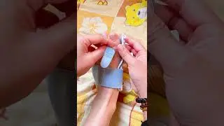 Doctor-Style Ingrown Toenail CorrectionPerfect Nail Alignment