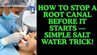 ✅Heal Your Tooth Pain Naturally with Salt Water (No Root Canal Needed)