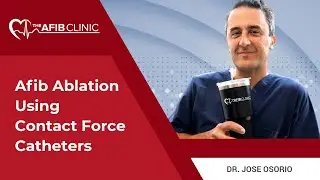 Afib Ablation using contact force catheters