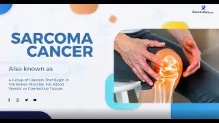 Sarcoma Cancer Awareness: Early Signs You Shouldn&rsquo;t Ignore | CancerGuru