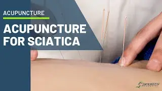 Иглоукалывание при болях в пояснично-крестцовом отделе
