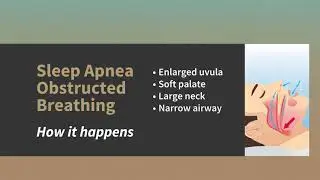 Sleep Apnea in Bolivia & Oak Island