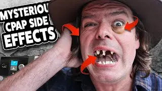 Mysterious CPAP Side Effects - Puffy Eyes, Ear Pain & Tooth Decay