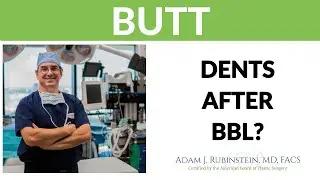 Plastic Surgery Truths: Dents After a BBL