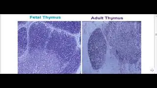 Lymphoid practical