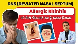 DNS(Deviated Nasal Septum) और Allergic rhinitis क्या होता हैं? जानिए इसके कारण और ईलाज ।।