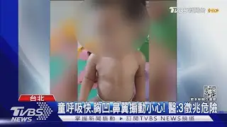 童呼吸快.胸凹.鼻翼搧動小心! 醫:3徵兆危險｜TVBS新聞