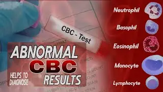 CBC test ki report check karne Ka tarika || How to Check Abnormal CBC Test Results in Urdu & Hindi ?