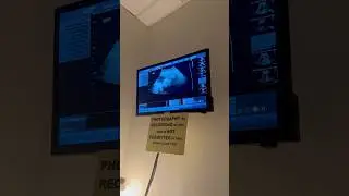 My first sonogram! 👀 #ilovejuliana#ultrasound#sonogram#4dultrasound#itsababy#babygirl#baby#pregnant