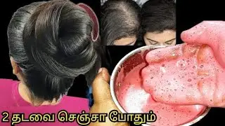 இந்த சீக்ரெட் தெரிஞ்சா வழுக்கை தலை பேச்சுக்கே இடமில்லை!! கொத்து கொத்தாக முடி வளரும் hair growth 