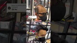 Harga 7jt mah bisa 3 kali pemasangan bro di HAIRYTALE 🫡  #toupee #botak #hairytale