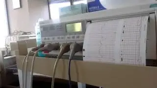 This my latest NST contractions monitoring video