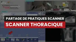 CT Scanner THORACIQUE (Sans Injection) - Partage de Pratiques