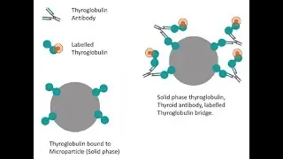 Anti-thyroid Antibodies Test ; Thyroid Peroxidase Antibodies , Thyroglobulin Antibodies, Thyrotropin