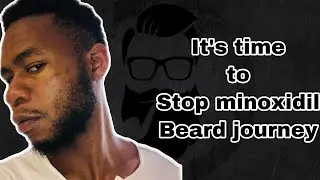 Stop Minoxidil beard journey after two years