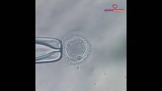IVF Treatment | Best IVF centre in Lucknow: Urvara Fertility Centre | Dr. Richa Singh