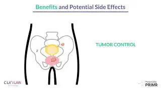 What is PSMA Radionuclide Treatment? | ZERO Prostate Cancer & Curium