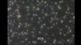 TiO2 in acoustic cell