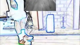 Achilles Tendon Rupture Recovery - Moving to 2 Shoes in Week 9